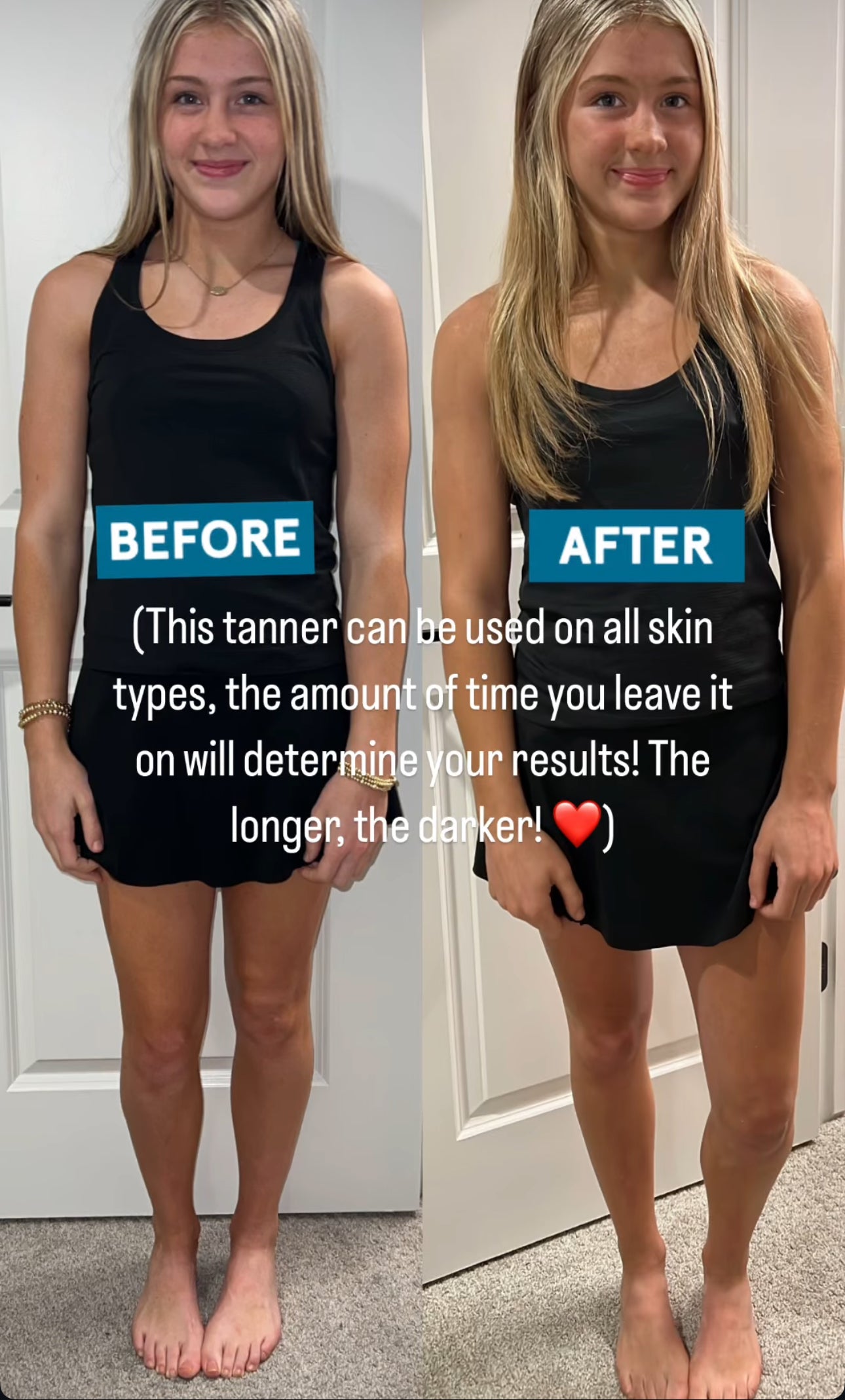 GlowMe Starter Kit LARGE